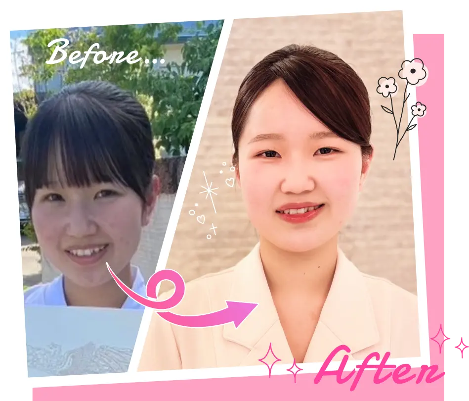 ビフォーアフターの写真